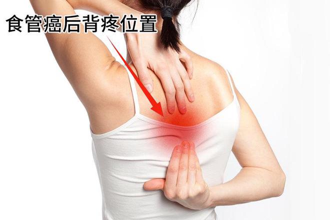 kaiyun体育网页版全球一半食管癌在中国！再次提醒：家中4种食物尽快撤下餐桌(图3)