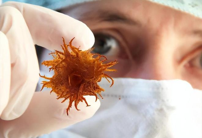 被列为2A级的致癌物竟每天开云体育都在餐桌上如何降低饮食风险？(图3)