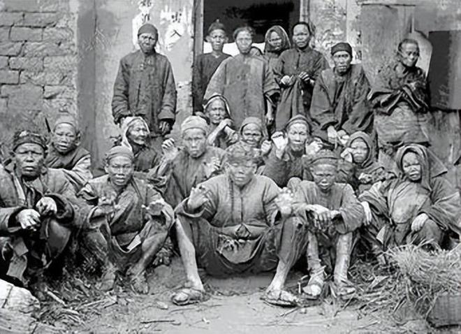 潜伏餐桌的杀手：150克就能致命却被端上餐桌至今仍大量种植(图2)