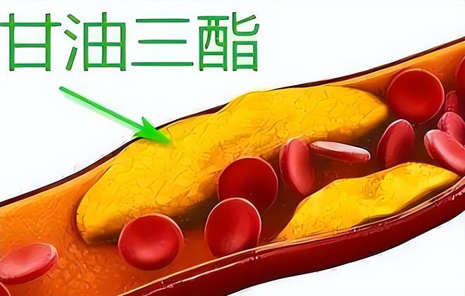 数名院士呼吁冠心病患者停止食用比甜食还粘血管趁早撤kaiyun体育网页版下餐桌(图4)